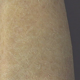Foto Nahaufnahme von sehr trockener, schuppiger Haut